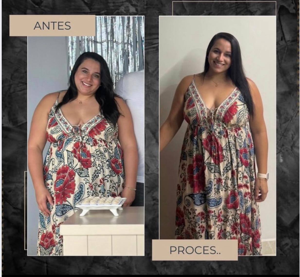 Resultado de aluna: antes e depois